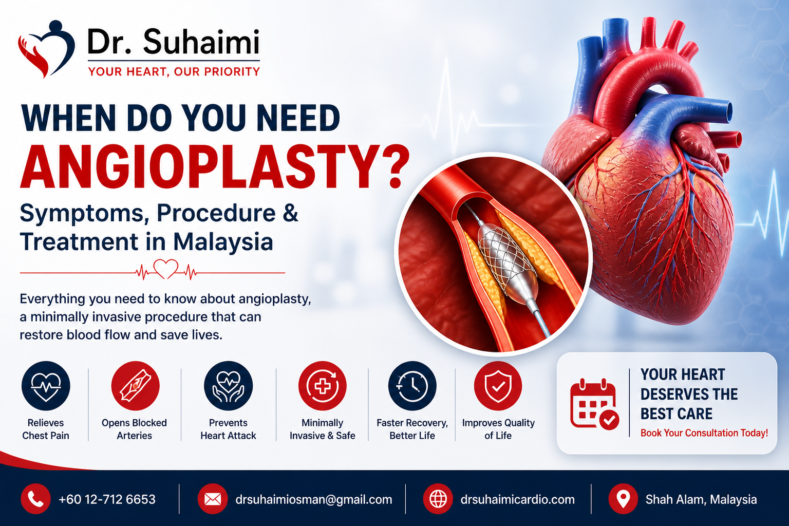 When Do You Need Angioplasty? Symptoms, Procedure & Treatment in Malaysia