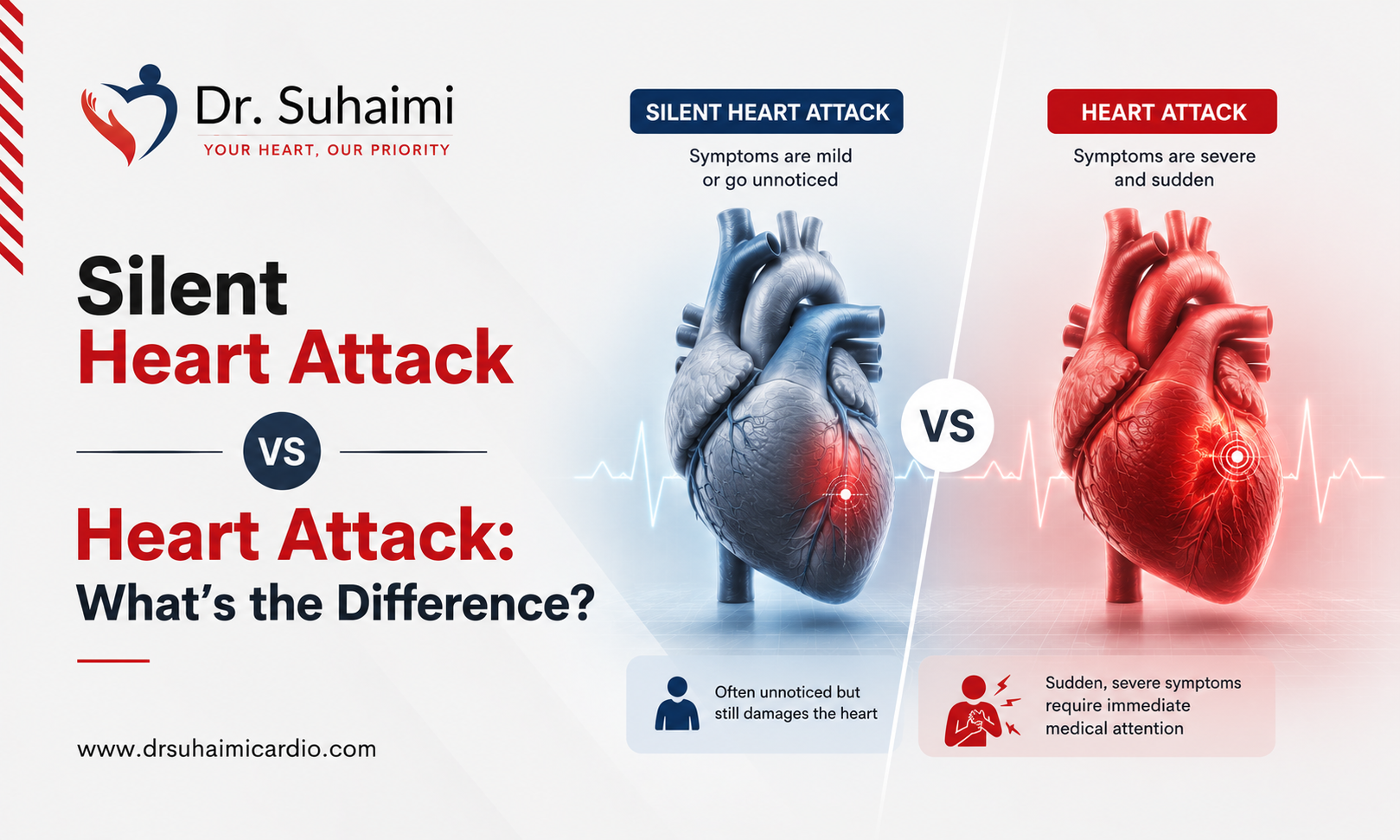 Silent Heart Attack vs Heart Attack: What’s the Difference?