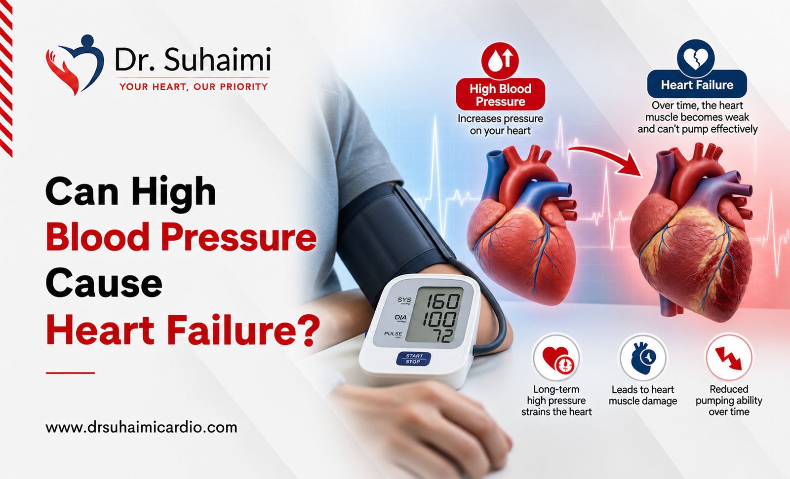 Can High Blood Pressure Cause Heart Failure?